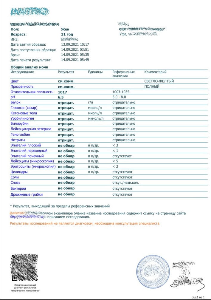 Общий анализ мочи (ОАМ)